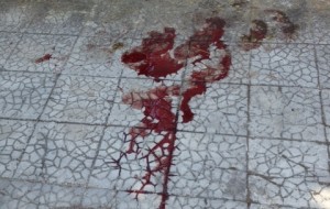 Anziano azzannato da due cani