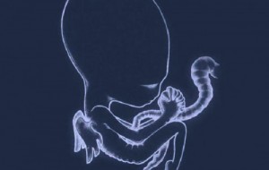 Sigur Rós – Ágætis Byrjun