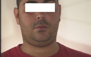 Evasione dai domiciliari: un arresto ad Ostuni
