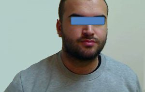 Si sono costituiti i due brindisini evasi dal carcere di Foggia
