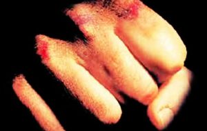 Aggredisce il padre fratturandogli due costole: arrestato 40enne
