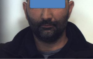 Rimuove placche antitaccheggio per rubare giubbino di marca: arrestato 44enne