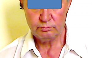 Lite tra due uomini: uno finisce in carcere, l’altro in ospedale con l’occhio destro sfregiato