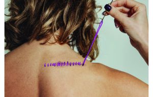 Mesagne aderisce al progetto “frAGILE”: l’arte per raccontare e sconfiggere il cancro