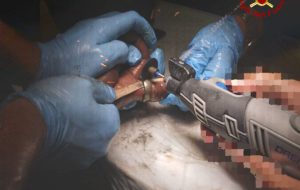 Francavilla Fontana, Vigili del Fuoco in ospedale per rimuovere un anello bloccato al dito di un paziente